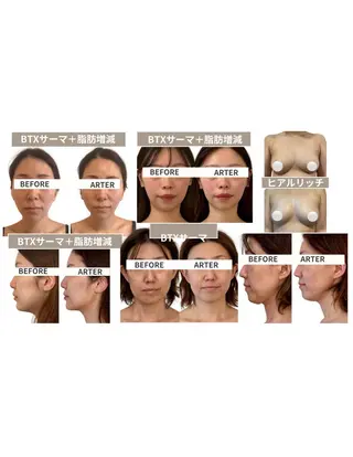 小顔専門看護師クリニカルサロンCOCO所属・小顔と美肌サロン クリニカルサロンココのエステ・リラクイメージ