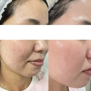 毛穴に特化したサロン MYFAIRLADYのエステ・リラクイメージ