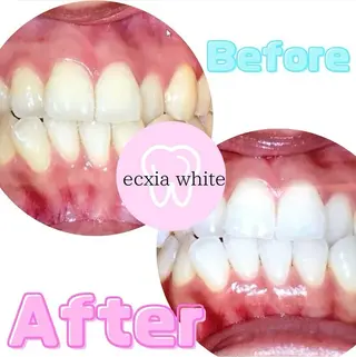 エクシアホワイトニング草津店所属・nanami -ホワイトニングのその他イメージ