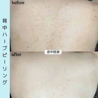 ベラージュ【美背中・ 美尻・フェイシャル】のエステ・リラクイメージ