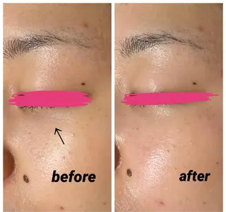 DeI'm   名古屋栄所属・小林 玲菜のエステ・リラクイメージ