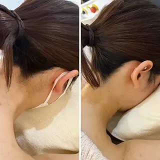 うなじ脱毛/美肌脱毛 LABELのエステ・リラクイメージ