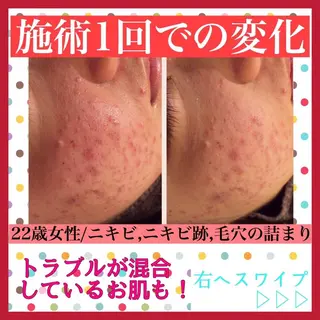 ミディアム カラー パーマ ヘアアレンジ メンズ キッズ ネイル マツエク・マツパ ニキビ・肌質改善専門 ♡人生が変わるサロンのエステ・リラクイメージ