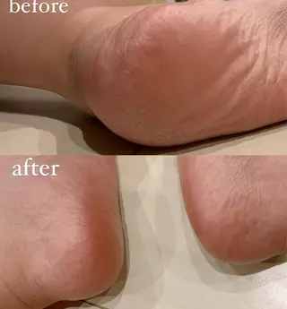 SHIKI モリンガ蒸し/水光肌のエステ・リラクイメージ