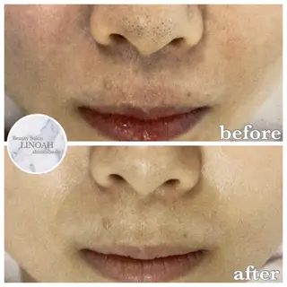 メンズ ビューティーサロン リノア心斎橋店のエステ・リラクイメージ