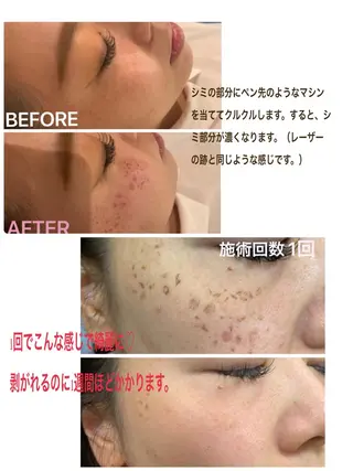 首・肩こり専門リンパ ケアサロンSENKAのエステ・リラクイメージ