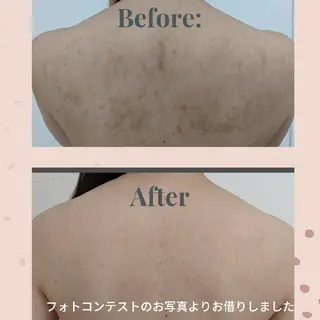 Cantik Cantik チャンティチャンティ所属・高橋 志保のエステ・リラクイメージ