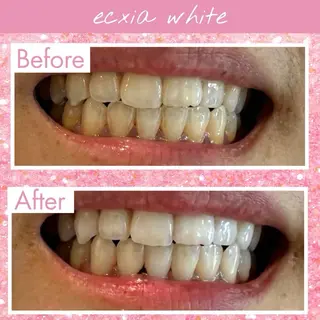 セルフホワイトニング エクシア大府店のその他イメージ