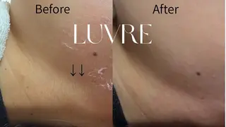 LUVRE/北区 龍田/MIKIのエステ・リラクイメージ