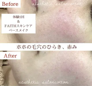 都度払い 肌質改善専門サロンのエステ・リラクイメージ