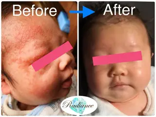 札幌ホワイトニング ラディアンス札幌駅店のその他イメージ