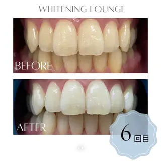 ホワイトニングラウンジ横須賀所属・ホワイトニング Lounge横須賀のその他イメージ