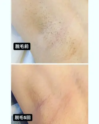 脱毛・エステサロン LuLuNのエステ・リラクイメージ