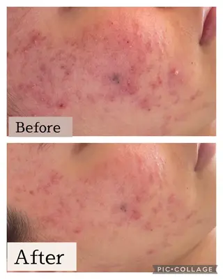 美肌サロン　ナゴミプラス所属・美肌とヘッド　和み+ 福　千賀子のエステ・リラクイメージ