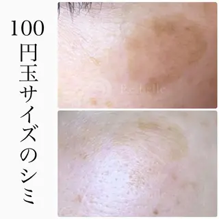 ハーブピーリング専門 BIOEL横浜のエステ・リラクイメージ