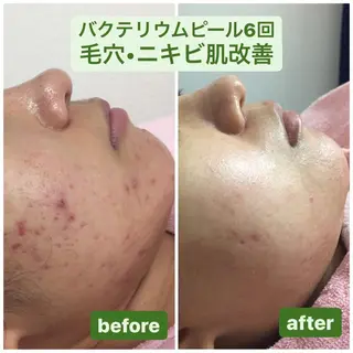 透明感の肌Lino malieのエステ・リラクイメージ