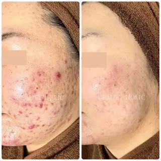 ビューティーホリック 東金店のエステ・リラクイメージ