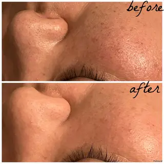 メンズ メナード岐阜市茜部 杉浦のエステ・リラクイメージ