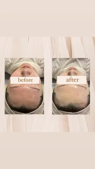 crescent所属・【韓国肌管理・脱毛】 クレセントのその他イメージ