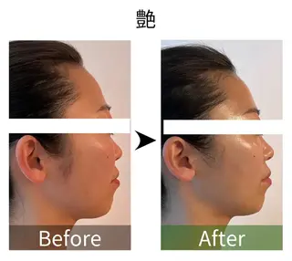 ハーブピーリング専門 muro.のエステ・リラクイメージ