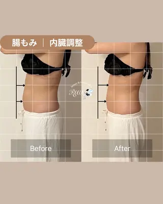 【頭痛、睡眠改善】 salon RUUのエステ・リラクイメージ