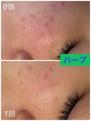 Private Salon Prunelle所属・プライベートサロン プリュネルのエステ・リラクイメージ