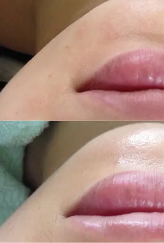 HIRAMORI E.T.S所属・HIRAMORI E.T.Sのエステ・リラクイメージ