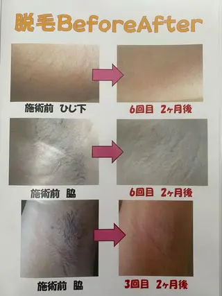 痩身リラク専門サロン 〜LUCIALL 〜のエステ・リラクイメージ