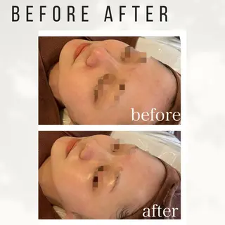 Beauty salon ハピー所属・大人女性のための 肌管理サロン　ハピーのエステ・リラクイメージ