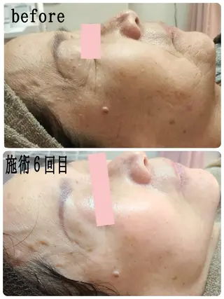 小顔と美肌 まごころエステMatoria所属・小顔 美肌専門 Matoriaのエステ・リラクイメージ