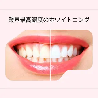 whitening salon yatto.所属・ホワイトニングサロン yatto.のその他イメージ