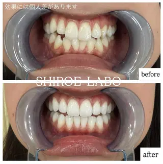 【歯のホワイトニング専門店】シロエラボ梅田店所属・シロエラボ 梅田店のその他イメージ