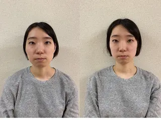 美容整体　小顔矯正 プラスフィール飯野のエステ・リラクイメージ