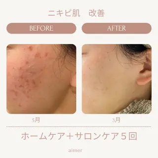 aimer beautyのエステ・リラクイメージ