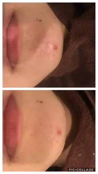 ロング パーマ ヘアアレンジ メンズ ネイル マツエク・マツパ 四つ星サロン🎖 腸＆ニキビケアに特化のエステ・リラクイメージ