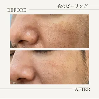 デ･アイム あま所属・かすみ🌹あま/ エステのエステ・リラクイメージ