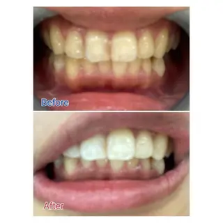 M渋谷店所属・M渋谷 ホワイトニングのエステ・リラクイメージ