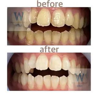 ホワイトニング ショップ船橋店🦷のエステ・リラクイメージ