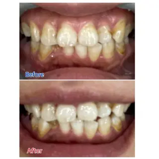 M渋谷店所属・M渋谷 ホワイトニングのその他イメージ