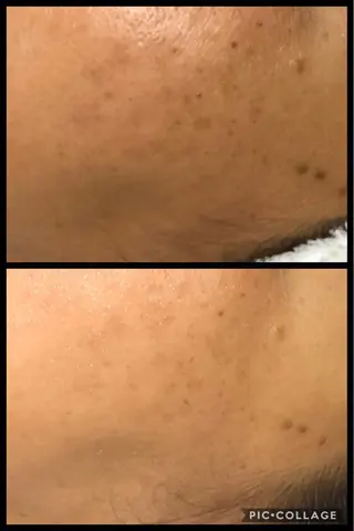 エスカル ボーテのエステ・リラクイメージ