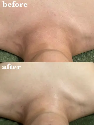 メンズ 【肌質改善サロン】 リーフィアのエステ・リラクイメージ