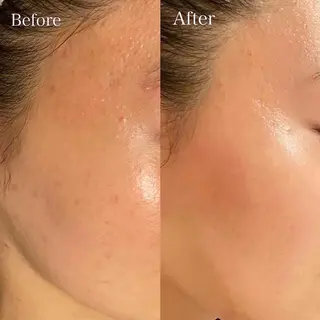 小顔×痩身専門サロンCLORE浦和店所属・石川 彩花のエステ・リラクイメージ