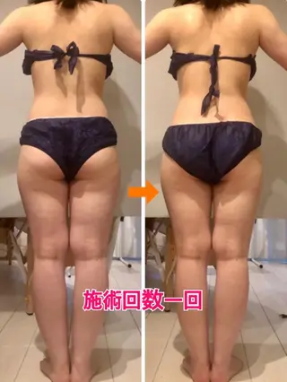 ロング カラー パーマ ヘアアレンジ メンズ キッズ ネイル マツエク・マツパ ‍痩身＆ボディ 結果出し🌟丹野のエステ・リラクイメージ