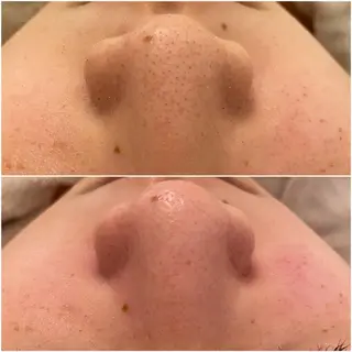 ララ/ハーブ メゾンリュバンのエステ・リラクイメージ