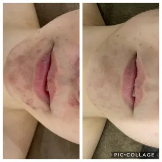 BeautySalonGemmy所属・Gemmy 愛美のエステ・リラクイメージ