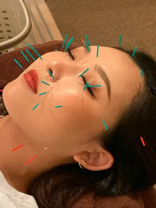 鍼灸整体院　蕾所属・美容鍼 蕾【谷町六丁目】のエステ・リラクイメージ