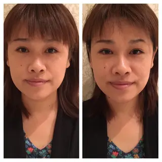 美容鍼サロン    Fleurir所属・伊藤 かなえのエステ・リラクイメージ