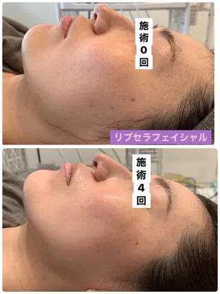 Private Salon Prunelle所属・プライベートサロン プリュネルのエステ・リラクイメージ