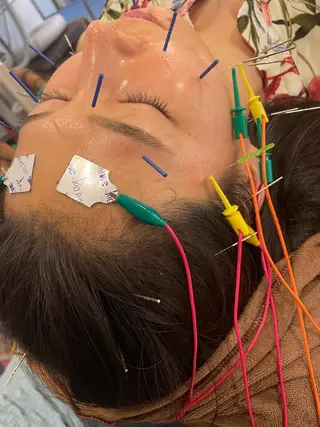 美容鍼灸サロン mahoroba院長のエステ・リラクイメージ