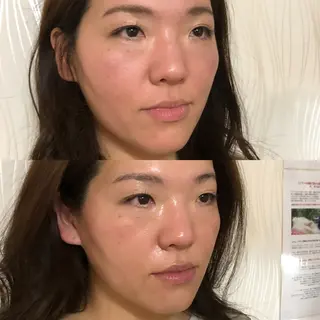 毛穴シミケア専門店aloha malie所属・水野 彩のエステ・リラクイメージ